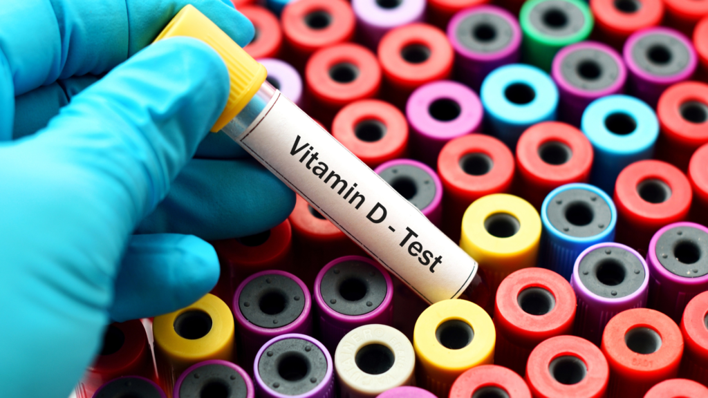 Mangel på vitamin D kan enkelt påvises ved en blodprøve.