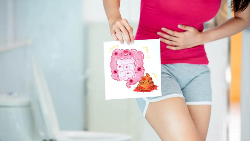 Opptil 20% av befolkningen observerer blod i avføringen i løpet av ett år