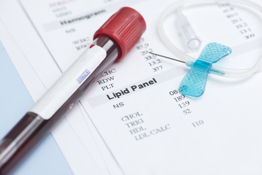 Nivået av lipoprotein kan måles i blodprøver