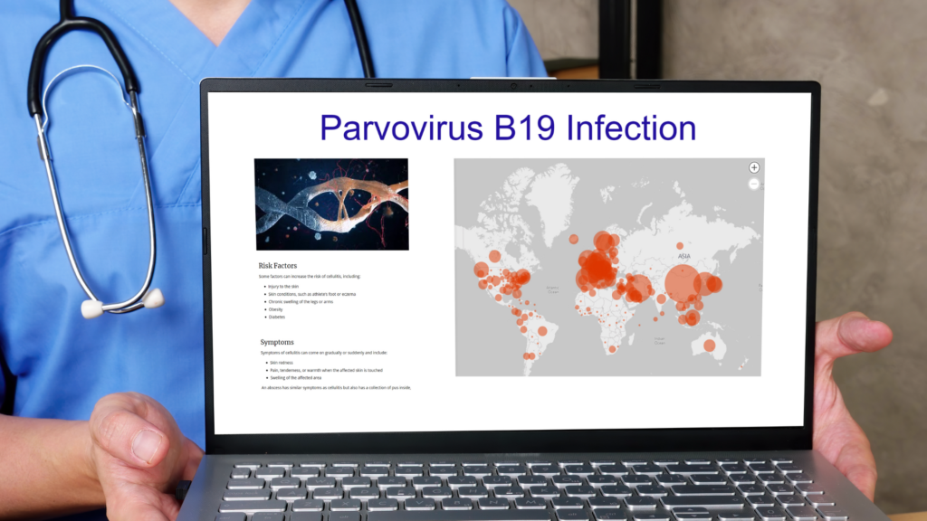 Parvovirus B19-infeksjon under graviditet kan imidlertid føre til spontanabort, infeksjon i fosterets lever og hjerte, alvorlig blodmangel og føtal hydrops