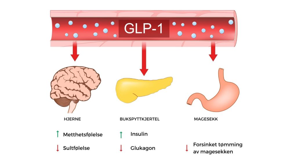 GLP1-analogene er de mest effektive medikamentet som benyttes i behandilng av overvekt per august 2023.