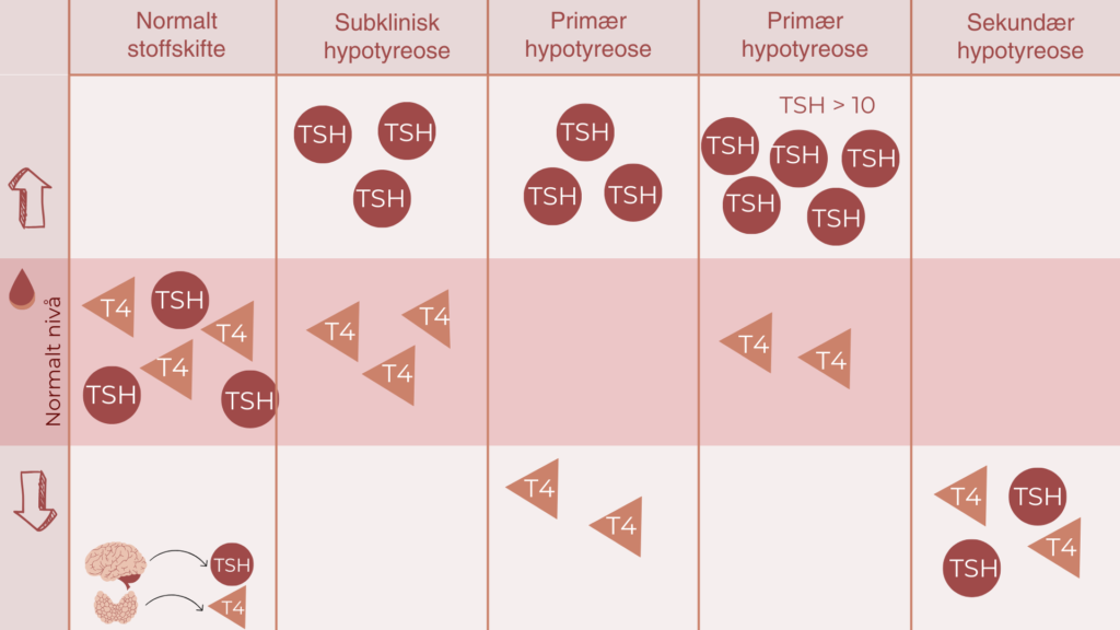 Diagnosene primær, sekundær eller subklinisk hypotyreose baseres på nivåene av TSH og fT4 i blodet.