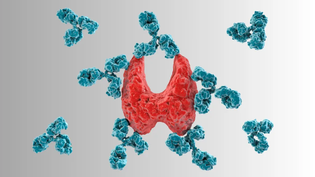Den vanligste årsaken til lavt stoffskifte er betennelse i skjoldbruskkjertelen, hvor kroppens eget immunsystemet danner antistoffer som angriper skjoldbruskkjertelen.