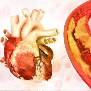 Kartlegging av fettstoffer og lipidproteiner er en sentral del av vurderingen når en persons risiko for hjerte- og karsykdom skal vurdere.